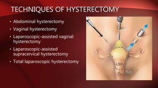 TECHNIQUES OF HYSTERECTOMY
• Abdominal hysterectomy
• Vaginal hysterectomy
• Laparoscopic-assisted vaginal
hysterectomy
• Laparoscopic-assisted
supracervical hysterectomy
• Total laparoscopic hysterectomy
 