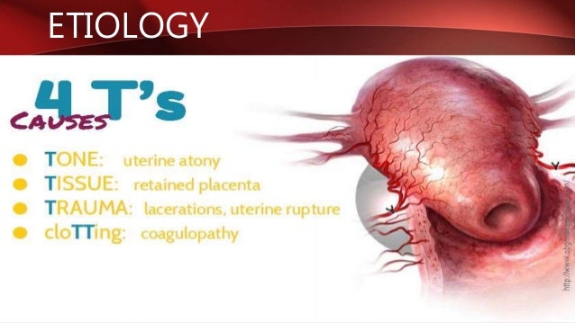 Postpartum Hemorrhage