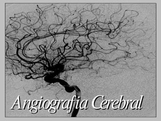 Angiografia Cerebral   