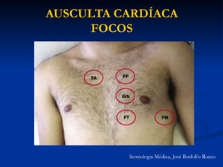 AUSCULTA CARDÍACA
FOCOS
Semiologia Médica, José Rodolfo Rocco
 