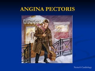 ANGINA PECTORIS
Netter’s Cardiology
 