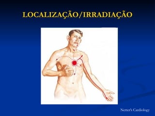 LOCALIZAÇÃO/IRRADIAÇÃO
Netter’s Cardiology
 