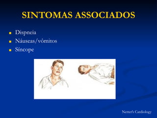SINTOMAS ASSOCIADOS
■ Dispneia
■ Náuseas/vômitos
■ Síncope
Netter’s Cardiology
 