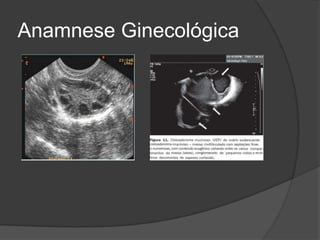 Anamnese Ginecológica

 