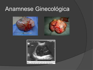 Anamnese Ginecológica

 