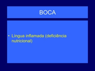 BOCA
• Língua inflamada (deficiência
nutricional)
 