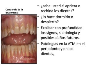 • ¿sabe usted si aprieta o
Conciencia de la
bruxomania
                     rechina los dientes?
                   • ¿lo hace dormido o
                     despierto?
                   • Explicar con profundidad
                     los signos, si etiología y
                     posibles daños futuros.
                   • Patologías en la ATM en el
                     periodonto y en los
                     dientes,
 