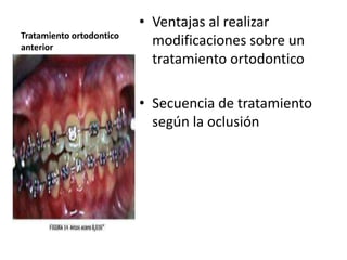 • Ventajas al realizar
Tratamiento ortodontico
anterior
                            modificaciones sobre un
                            tratamiento ortodontico

                          • Secuencia de tratamiento
                            según la oclusión
 