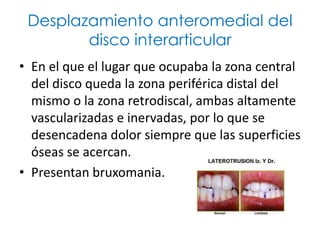 Desplazamiento anteromedial del
        disco interarticular
• En el que el lugar que ocupaba la zona central
  del disco queda la zona periférica distal del
  mismo o la zona retrodiscal, ambas altamente
  vascularizadas e inervadas, por lo que se
  desencadena dolor siempre que las superficies
  óseas se acercan.
• Presentan bruxomania.
 