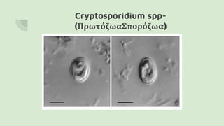 Cryptosporidium spp-
(ΠρωτόζωαΣπορόζωα)
 
