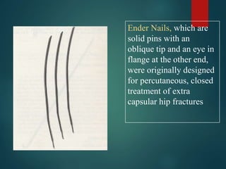 Ender Nails, which are
solid pins with an
oblique tip and an eye in
flange at the other end,
were originally designed
for percutaneous, closed
treatment of extra
capsular hip fractures
 