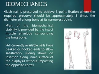 BIOMECHANICS
•Each nail is precurved to achieve 3-point fixation where the
required precurve should be approximately 3 times the
diameter of a long bone at its narrowest point.
•Part of the biomechanical
stability is provided by the intact
muscle envelope surrounding
the long bone.
•All currently available nails have
beaked or hooked ends to allow
satisfactory sliding down on
insertion along inner surface of
the diaphysis without impacting
the opposite cortex.
 