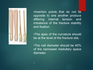 •Insertion points that do not lie
opposite to one another produce
differing internal tension and
imbalance of the fracture stability
and fixation.
•The apex of the curvature should
be at the level of the fracture site.
•The nail diameter should be 40%
of the narrowest medullary space
diameter.
•.
 