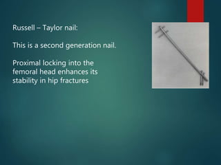 Russell – Taylor nail:
This is a second generation nail.
Proximal locking into the
femoral head enhances its
stability in hip fractures
 