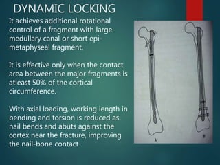 DYNAMIC LOCKING
It achieves additional rotational
control of a fragment with large
medullary canal or short epi-
metaphyseal fragment.
It is effective only when the contact
area between the major fragments is
atleast 50% of the cortical
circumference.
With axial loading, working length in
bending and torsion is reduced as
nail bends and abuts against the
cortex near the fracture, improving
the nail-bone contact
 