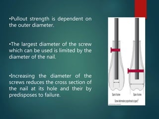 •Pullout strength is dependent on
the outer diameter.
•The largest diameter of the screw
which can be used is limited by the
diameter of the nail.
•Increasing the diameter of the
screws reduces the cross section of
the nail at its hole and their by
predisposes to failure.
 