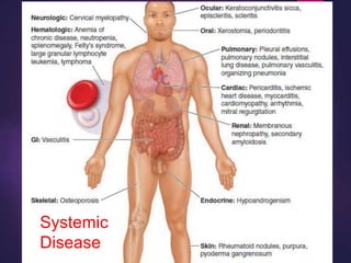 Systemic
Disease
 