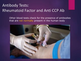 Antibody Tests:
Rheumatoid Factor and Anti CCP Ab
Other blood tests check for the presence of antibodies
that are not normally present in the human body
 