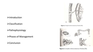 Enterocutaneous Fistula Diagram enterocutaneous-fistula-diagram