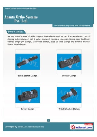 - Orthopedic Implants And Instruments -


Bone Clamps:

We are manufacturer of wide range of bone clamps such as ball & socket clamps, central
clamps, swivel clamps, t ball & socket clamps, t clamps, c transvrse clamps, open double pin
clamps, single pin clamps, transverse clamps, tube to tube clamps and dynamic external
fixator t end clamps.




           Ball & Socket Clamps                             Central Clamps




               Swivel Clamps                             T Ball & Socket Clamps
 