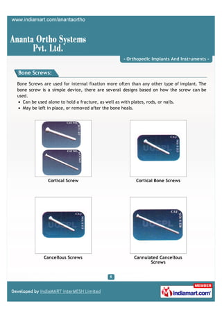 - Orthopedic Implants And Instruments -


Bone Screws:

Bone Screws are used for internal fixation more often than any other type of implant. The
bone screw is a simple device, there are several designs based on how the screw can be
used.
   Can be used alone to hold a fracture, as well as with plates, rods, or nails.
   May be left in place, or removed after the bone heals.




              Cortical Screw                           Cortical Bone Screws




            Cancellous Screws                          Cannulated Cancellous
                                                              Screws
 