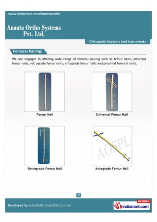- Orthopedic Implants And Instruments -


Femoral Nailing:

We are engaged in offering wide range of femoral nailing such ...