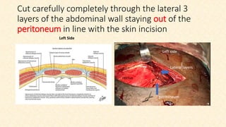 A new anterior acetabular approach | PPTX