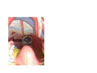 Ana phyev oandanatomist_1_