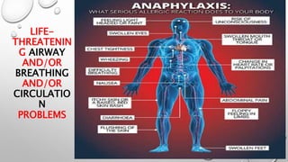 LIFE-
THREATENIN
G AIRWAY
AND/OR
BREATHING
AND/OR
CIRCULATIO
N
PROBLEMS
 