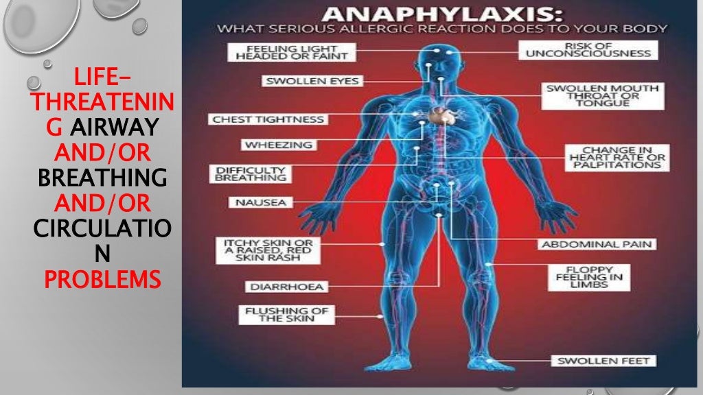 Anaphylactic shock