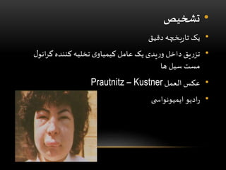 •‫تشخیص‬
•‫دقیق‬ ‫یخچه‬‫ر‬‫تا‬ ‫یک‬
•‫انو‬‫ر‬‫گ‬ ‫کننده‬ ‫تخلیه‬ ‫ی‬‫کیمیاو‬ ‫عامل‬ ‫یک‬ ‫یدی‬‫ر‬‫و‬ ‫داخل‬ ‫یق‬‫ر‬‫تز‬‫ل‬
‫ها‬ ‫سیل‬ ‫مست‬
•‫العمل‬ ‫عکس‬Prautnitz – Kustner
•‫ی‬ ‫ایمیونواس‬ ‫ادیو‬‫ر‬
 