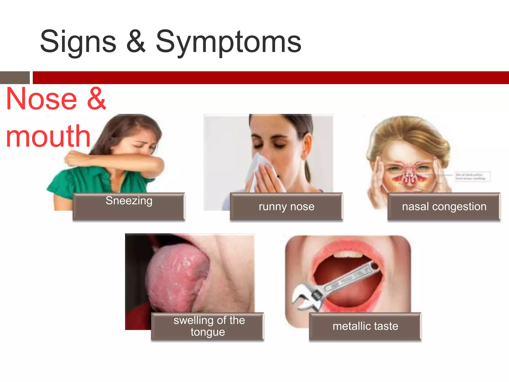 Signs & Symptoms
Nose &
mouth
      Sneezing
                                   runny nose                    nasal congestion




                 swelling of the
                                                metallic taste
                    tongue
 