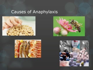 Causes of Anaphylaxis

 