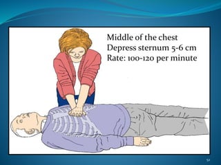 Middle of the chest
Depress sternum 5-6 cm
Rate: 100-120 per minute
52
 