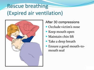 Rescue breathing
(Expired air ventilation)
After 30 compressions
 Occlude victim’s nose
 Keep mouth open
 Maintain chin lift
 Take a deep breath
 Ensure a good mouth-to-
mouth seal
 