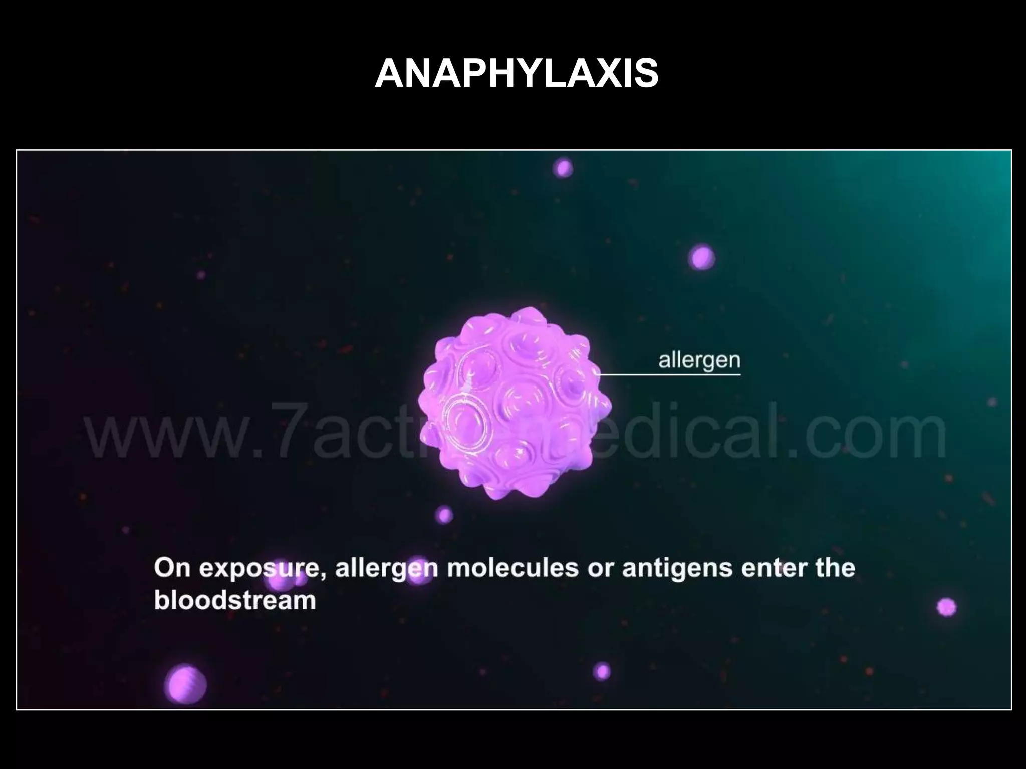 ANAPHYLAXIS
 
