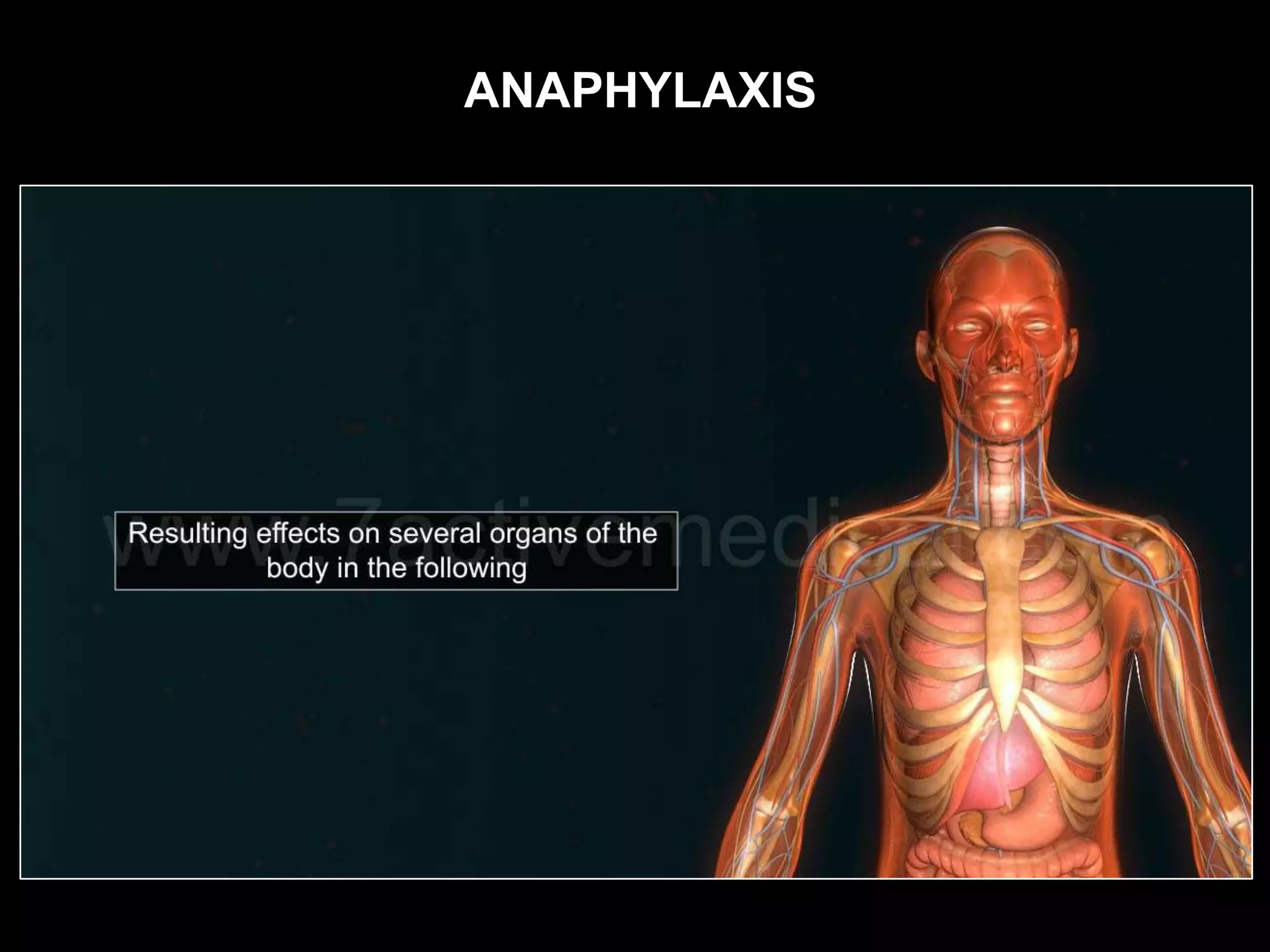 ANAPHYLAXIS
 