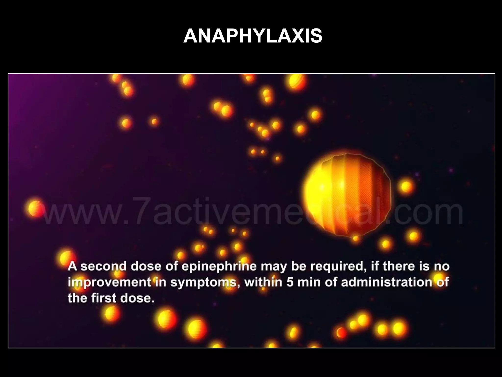 ANAPHYLAXIS
 