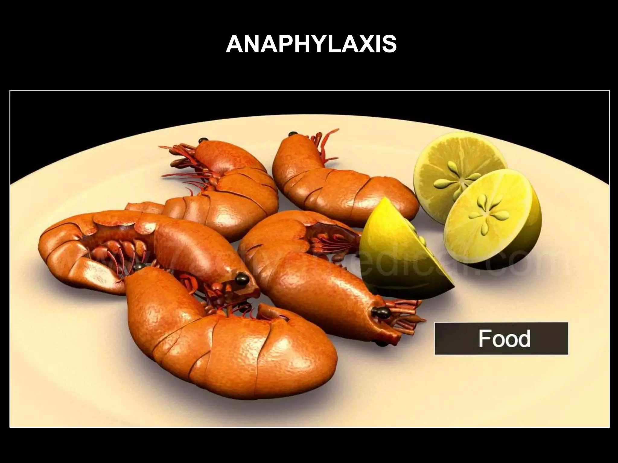 ANAPHYLAXIS
 