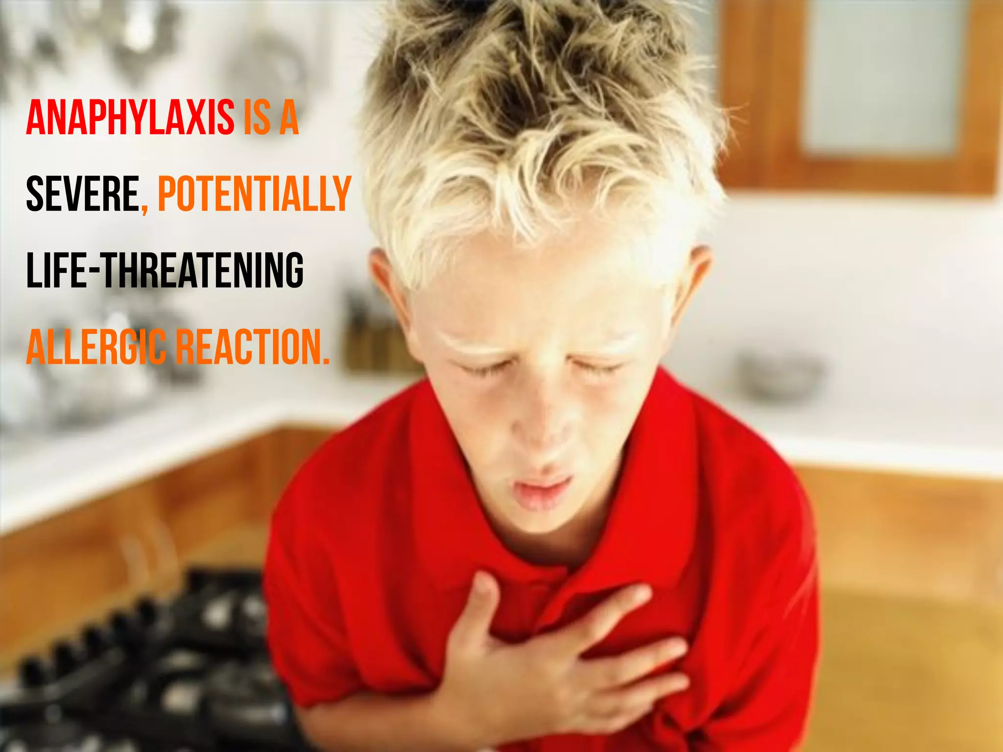 Anaphylaxis is a
severe, potentially
life-threatening
allergic reaction.
 