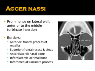 Comprehensive Anatomy and Physiology of the Nose and Paranasal Sinuses ...