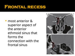 Comprehensive Anatomy and Physiology of the Nose and Paranasal Sinuses ...