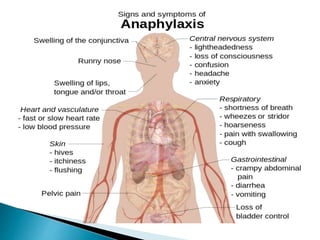 Anapilaksi