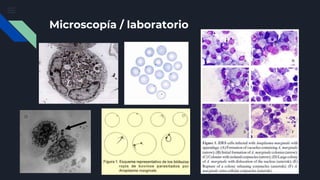 Microscopía / laboratorio
 