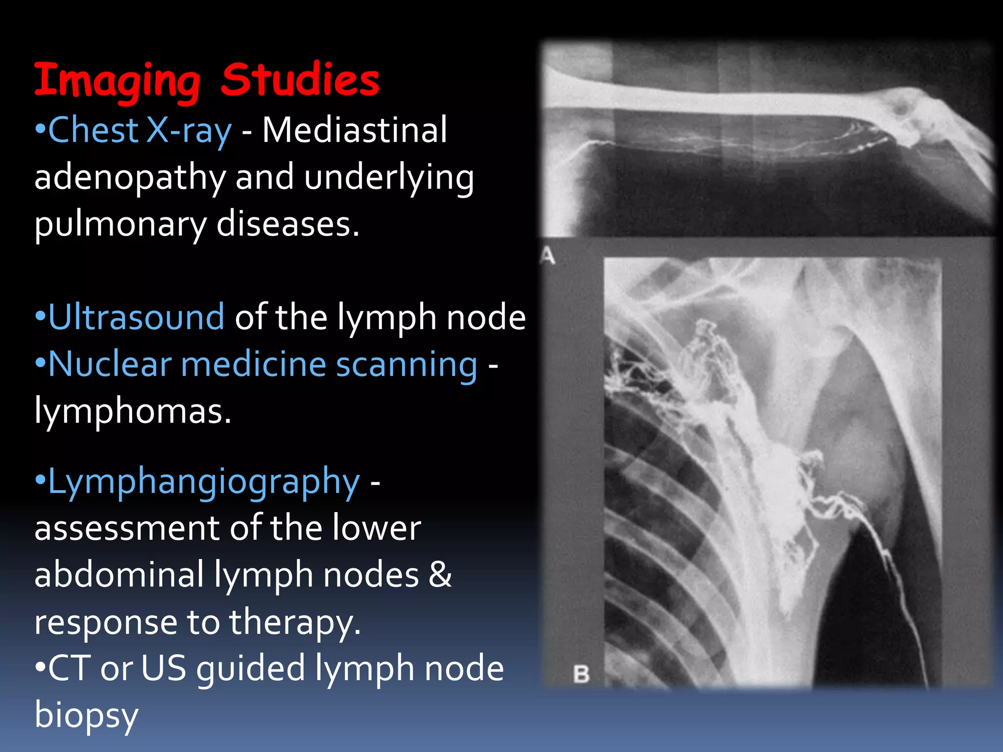 Imaging Studies
•Chest X-ray - Mediastinal
adenopathy and underlying
pulmonary diseases.
•Ultrasound of the lymph node
•Nuclear medicine scanning -
lymphomas.
•Lymphangiography -
assessment of the lower
abdominal lymph nodes &
response to therapy.
•CT or US guided lymph node
biopsy
 