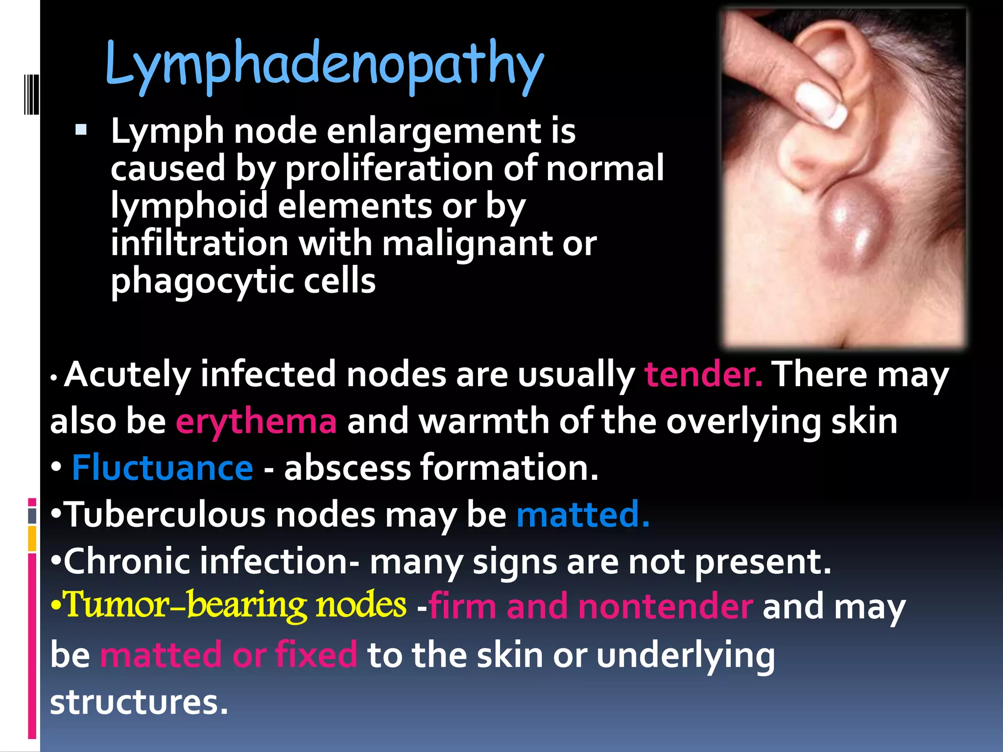 Lymphadenopathy
 Lymph node enlargement is
caused by proliferation of normal
lymphoid elements or by
infiltration with malignant or
phagocytic cells
• Acutely infected nodes are usually tender. There may
also be erythema and warmth of the overlying skin
• Fluctuance - abscess formation.
•Tuberculous nodes may be matted.
•Chronic infection- many signs are not present.
•Tumor-bearing nodes -firm and nontender and may
be matted or fixed to the skin or underlying
structures.
 