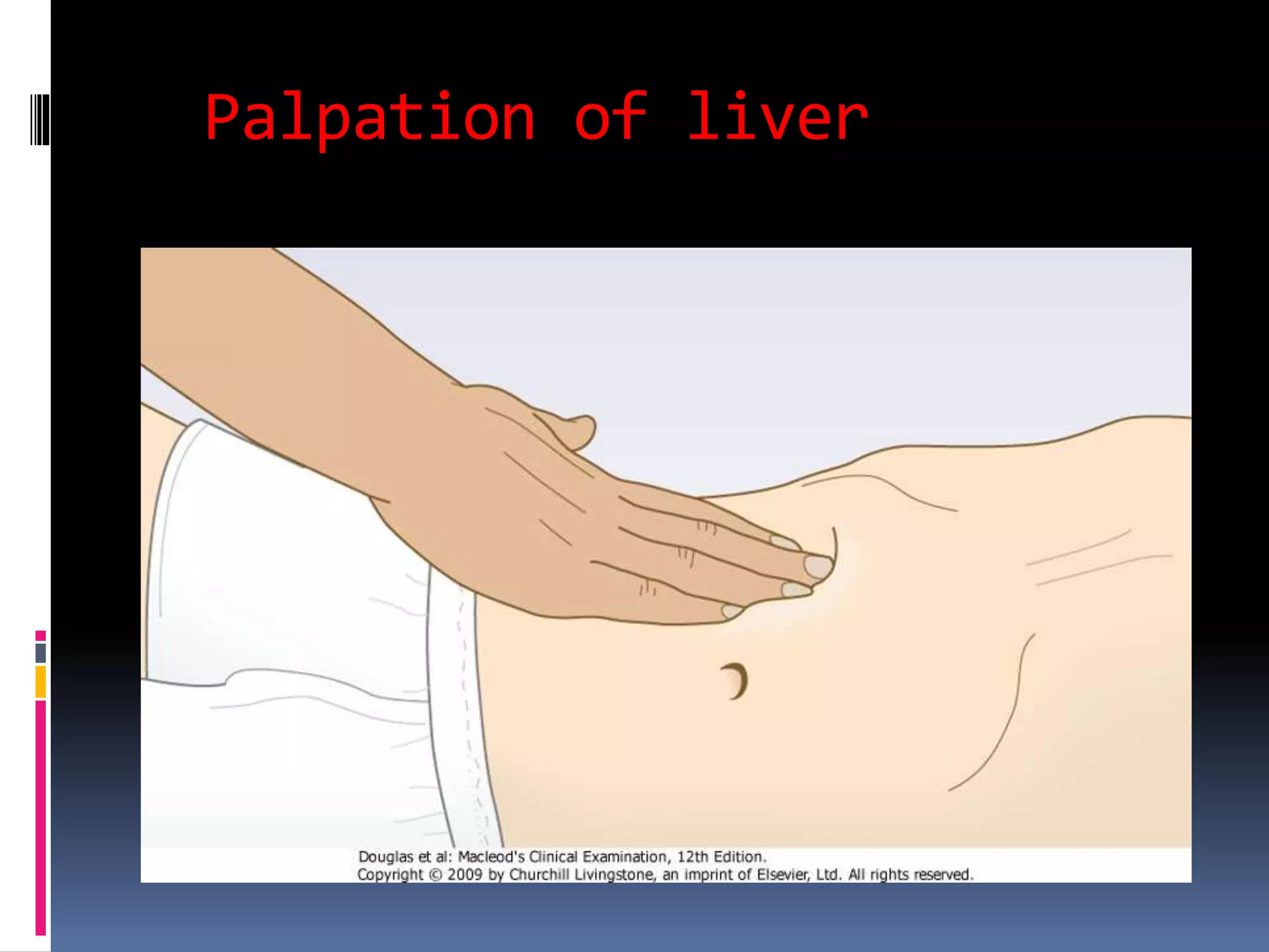 Palpation of liver
 