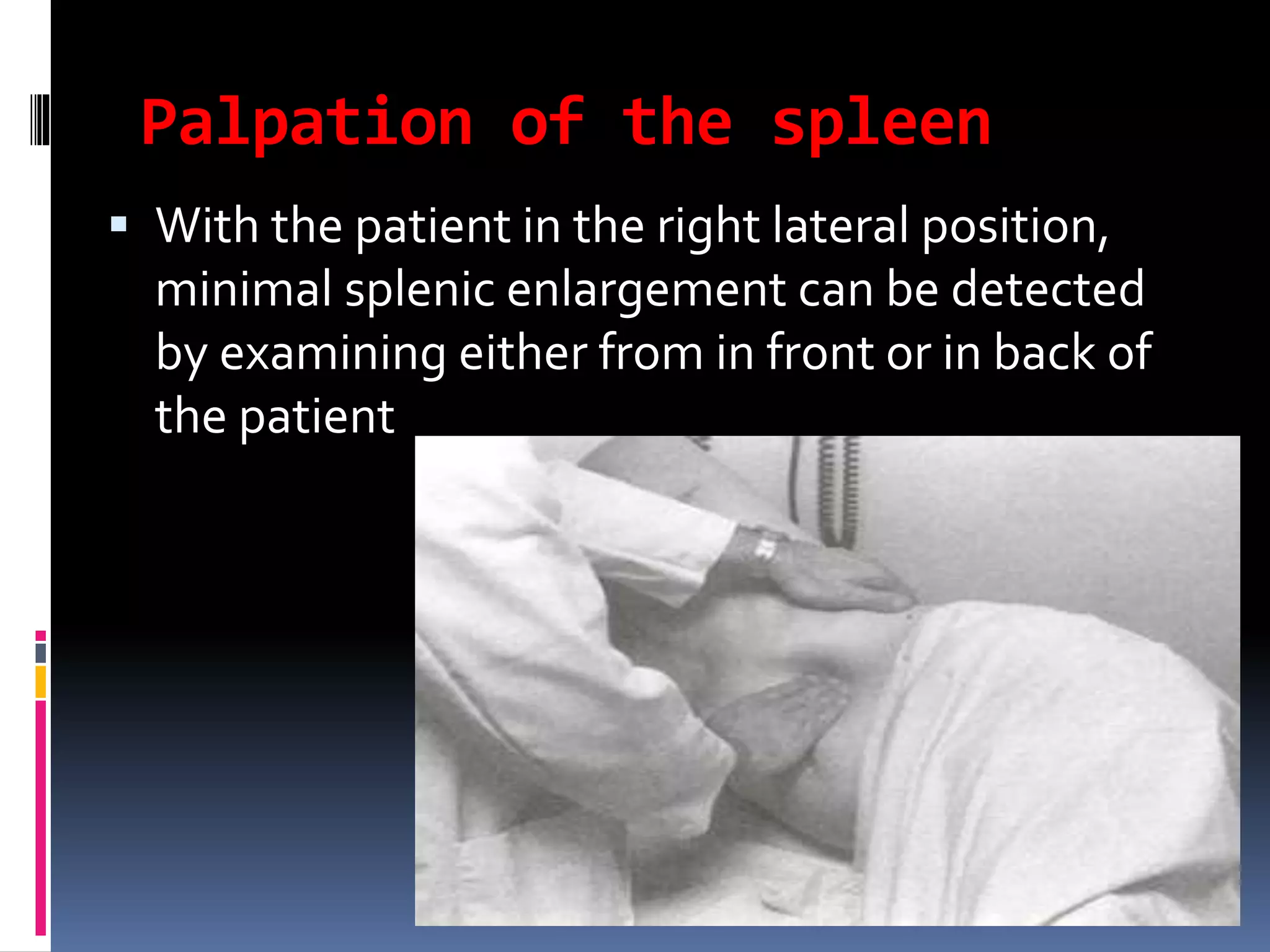 Palpation of the spleen
 With the patient in the right lateral position,
minimal splenic enlargement can be detected
by examining either from in front or in back of
the patient
 