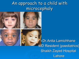 An approach to a child with
      microcephaly




              Dr.Anita Lamichhane
            MD Resident (paediatrics)
             Shaikh Zayed Hospital
                     Lahore
 