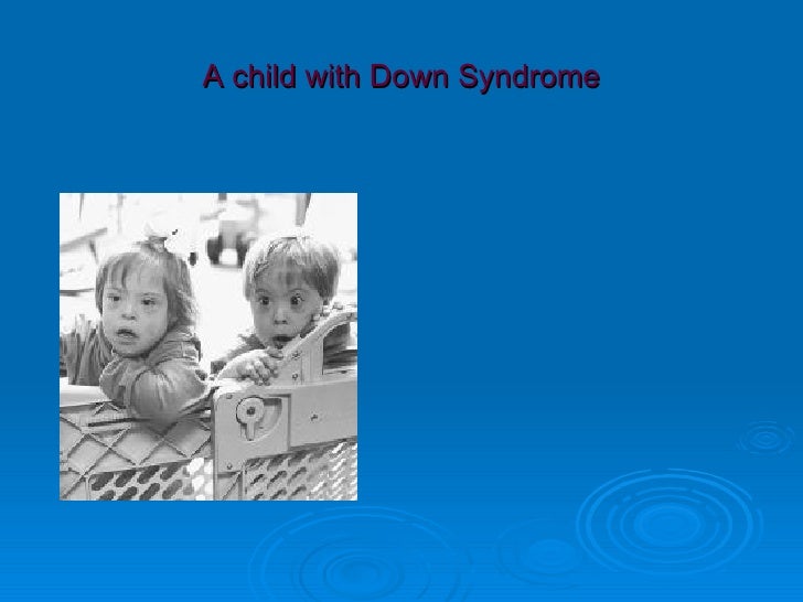 An approach to a chil with microcephaly